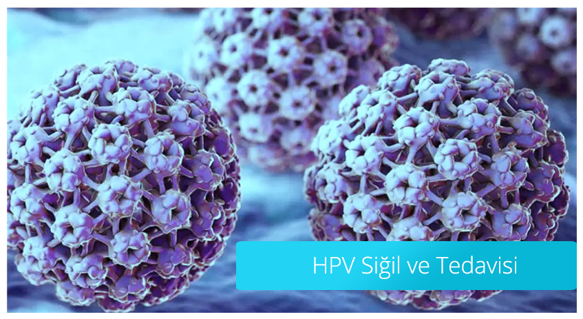 HPV Siğil ve Tedavisi ve Çözümü